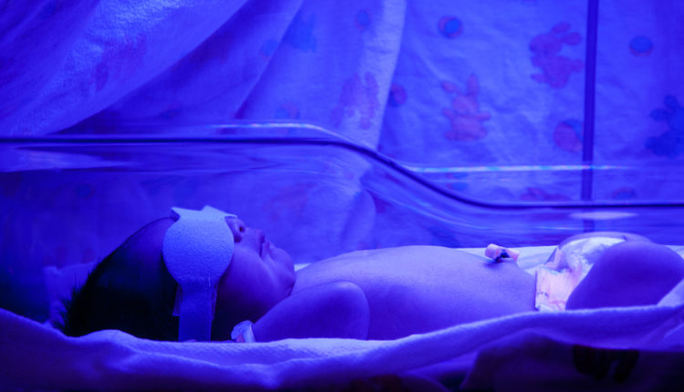 Everything you need to know about Jaundice in ‘New Born’ by Dr. Atul Chopra & Dr. Rahul Jain