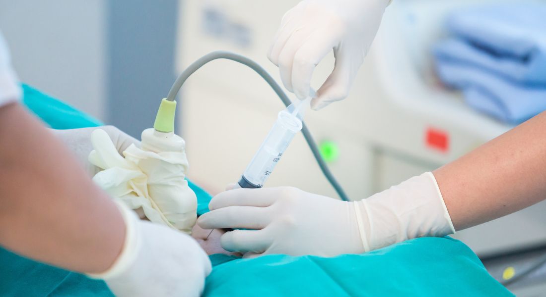 All You Need To Know About Amniocentesis