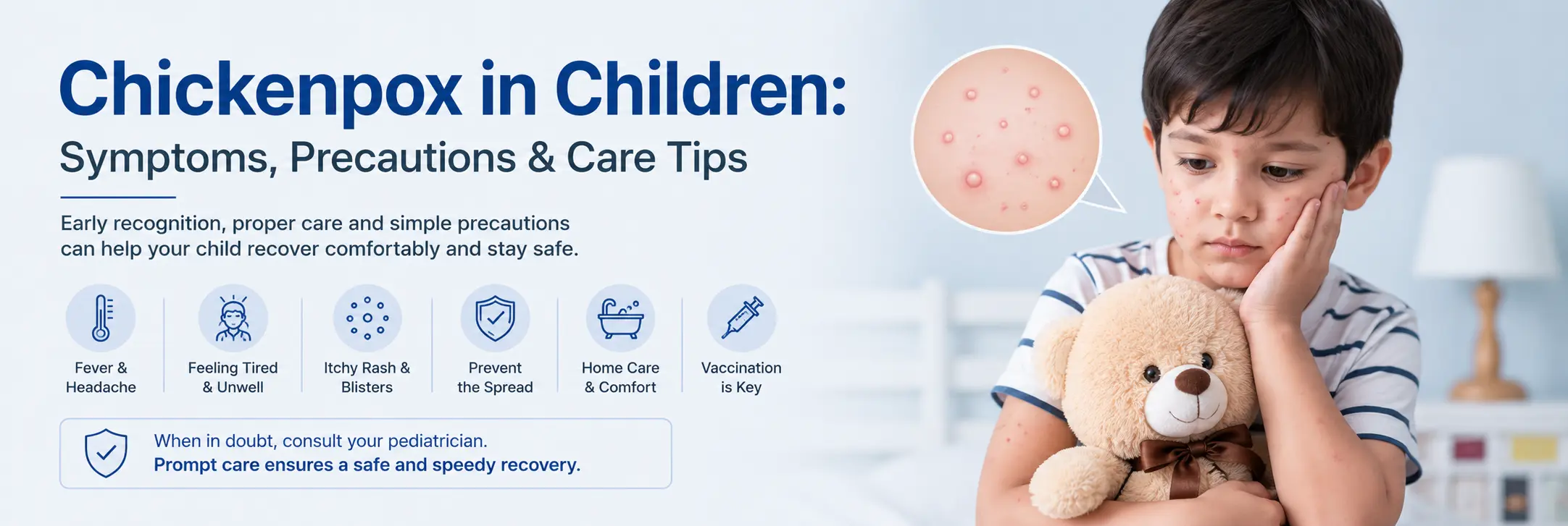 Symptoms and Precautions of Chickenpox in Children