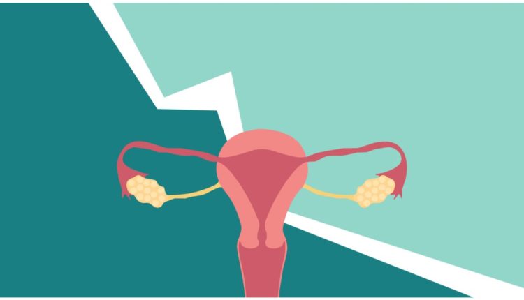 ENDOMETRIOSIS – HELP IS ON THE WAY