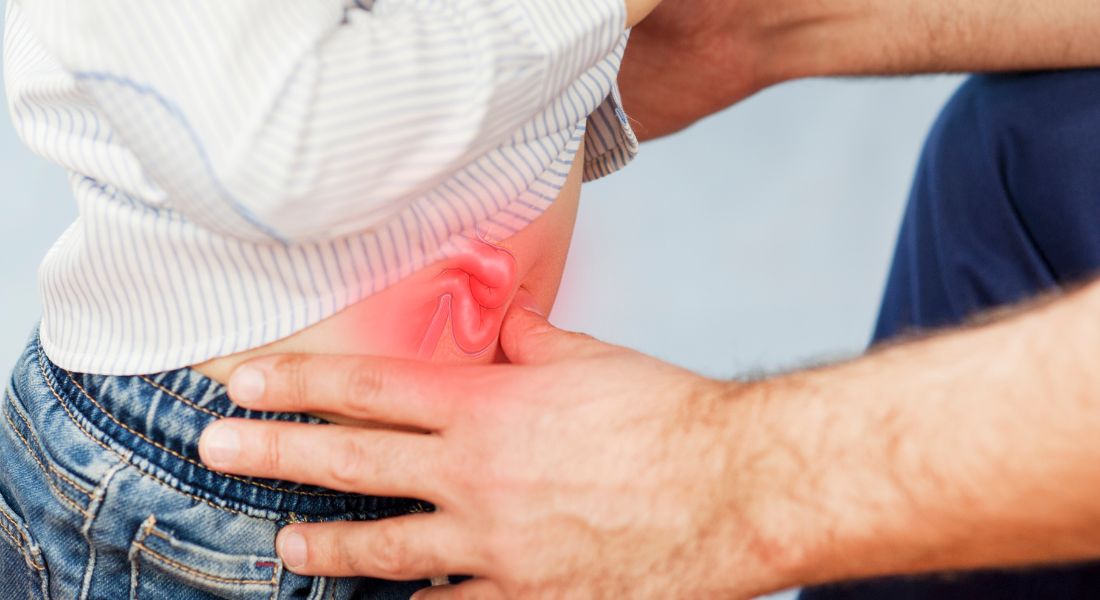 Hernia in Kids