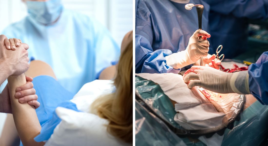 Natural Delivery versus C-section