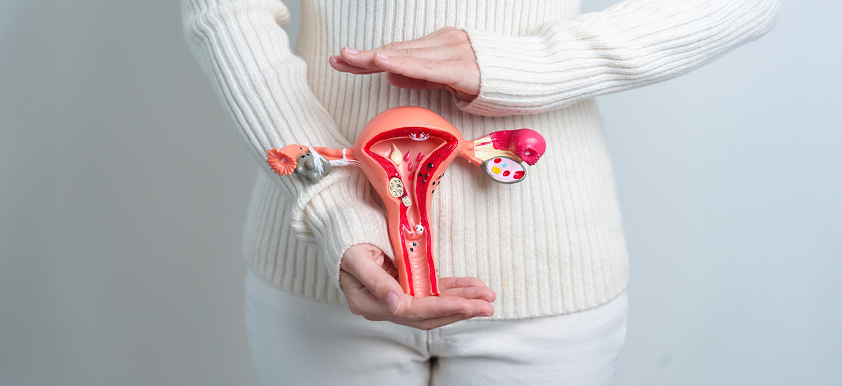 Stage 4 Endometriosis: Symptoms, Fertility Impact, and Treatment
