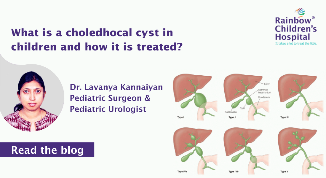 What is a choledhocal cyst in children and how it is treated?