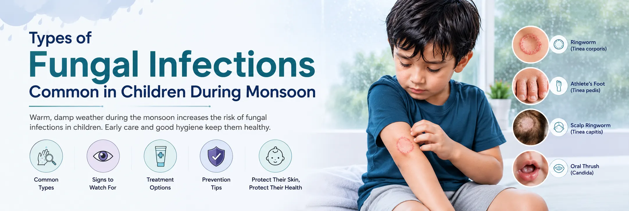 Types of Fungal Infections Common in Children During Monsoon