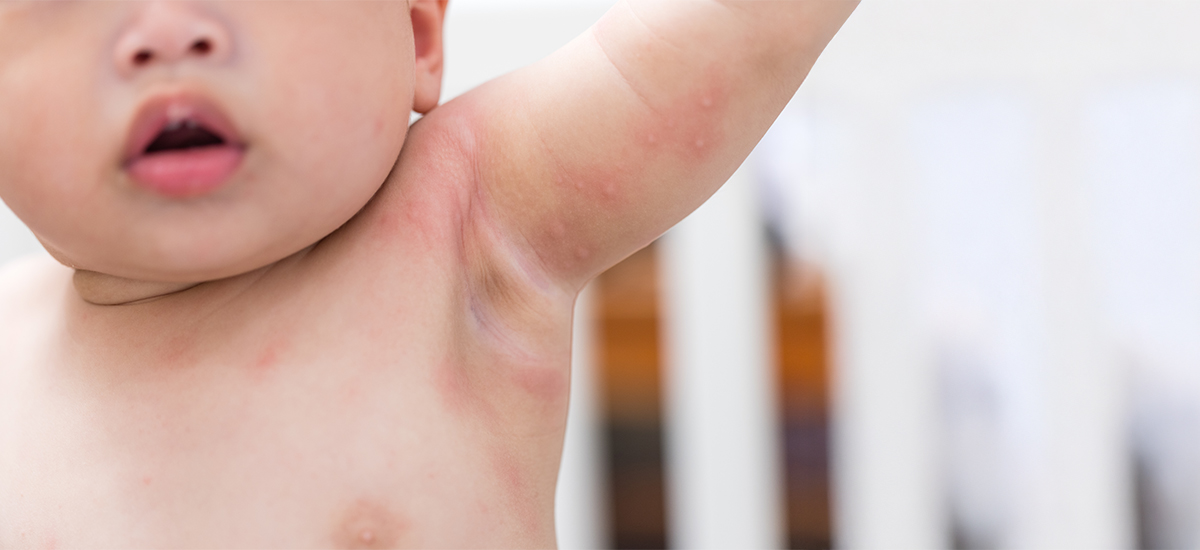 Pediatric Dermatology 101: How to Keep Your Child’s Skin Healthy and Rash-Free