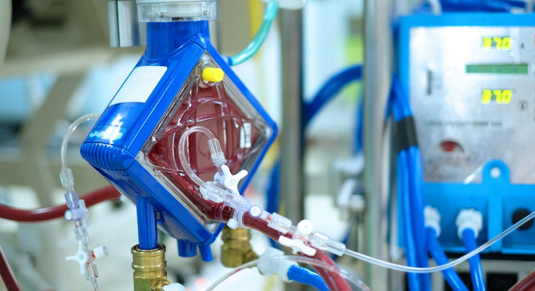 What Is Pediatric ECMO Treatment?