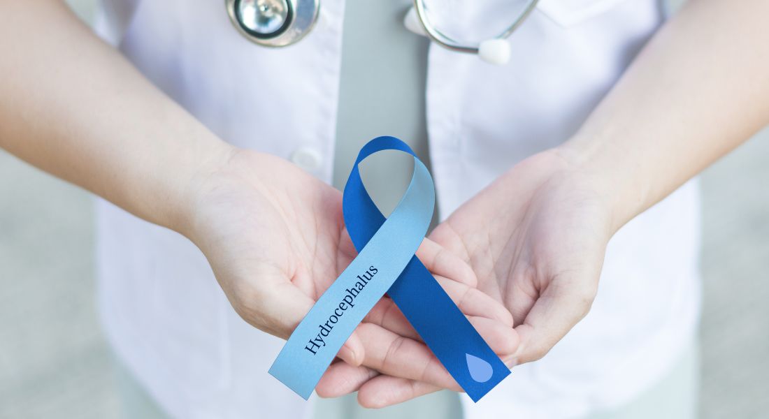 Hydrocephalus