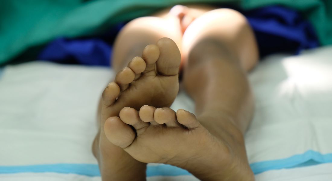 Do you know what Phimosis is?