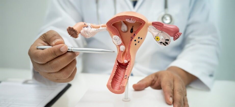 What is Cervical Polyp: Symptoms of Cervical Polyps