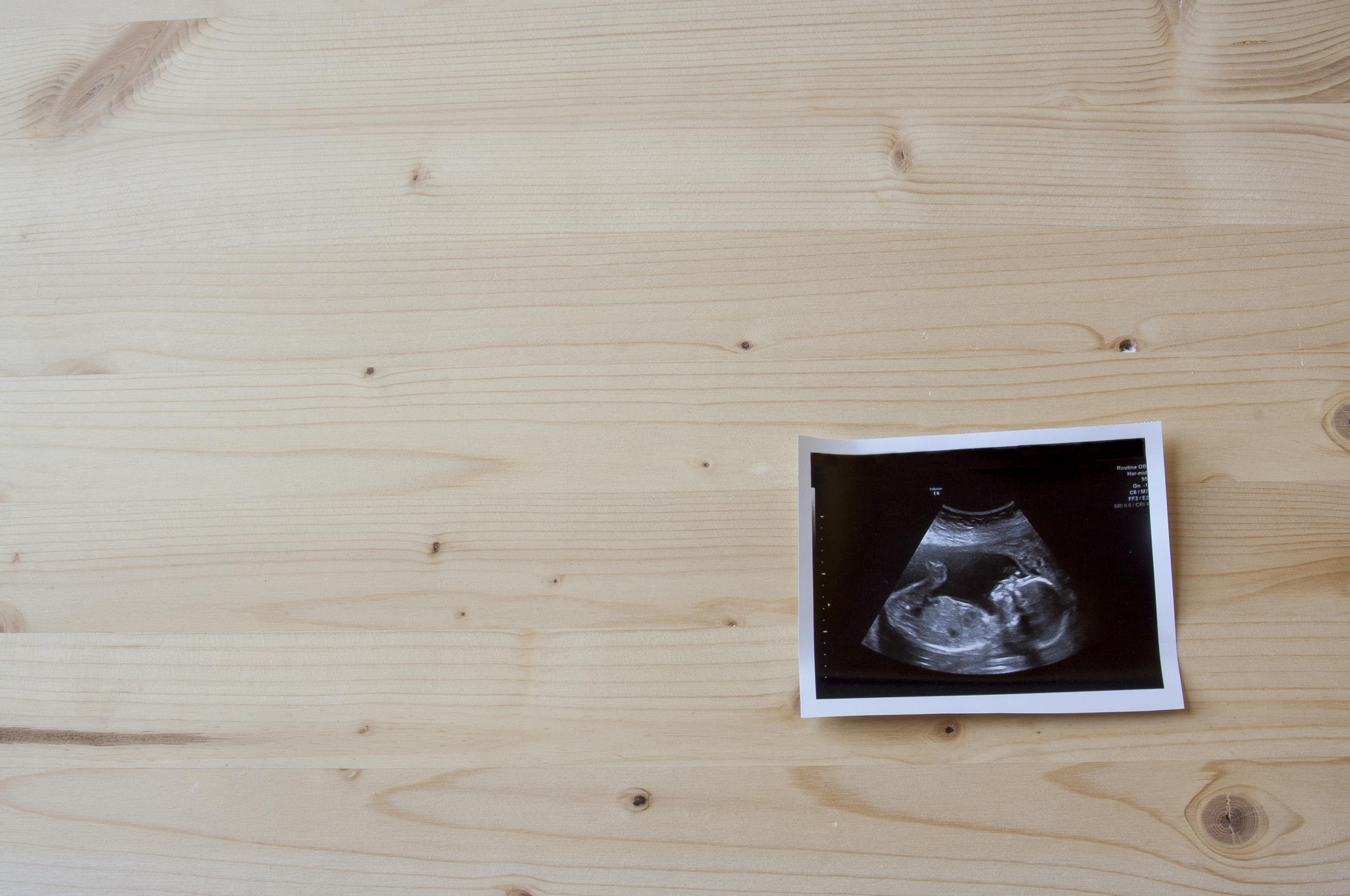 The first ultrasound is a WOW feeling by Dr. Beena Tiwari