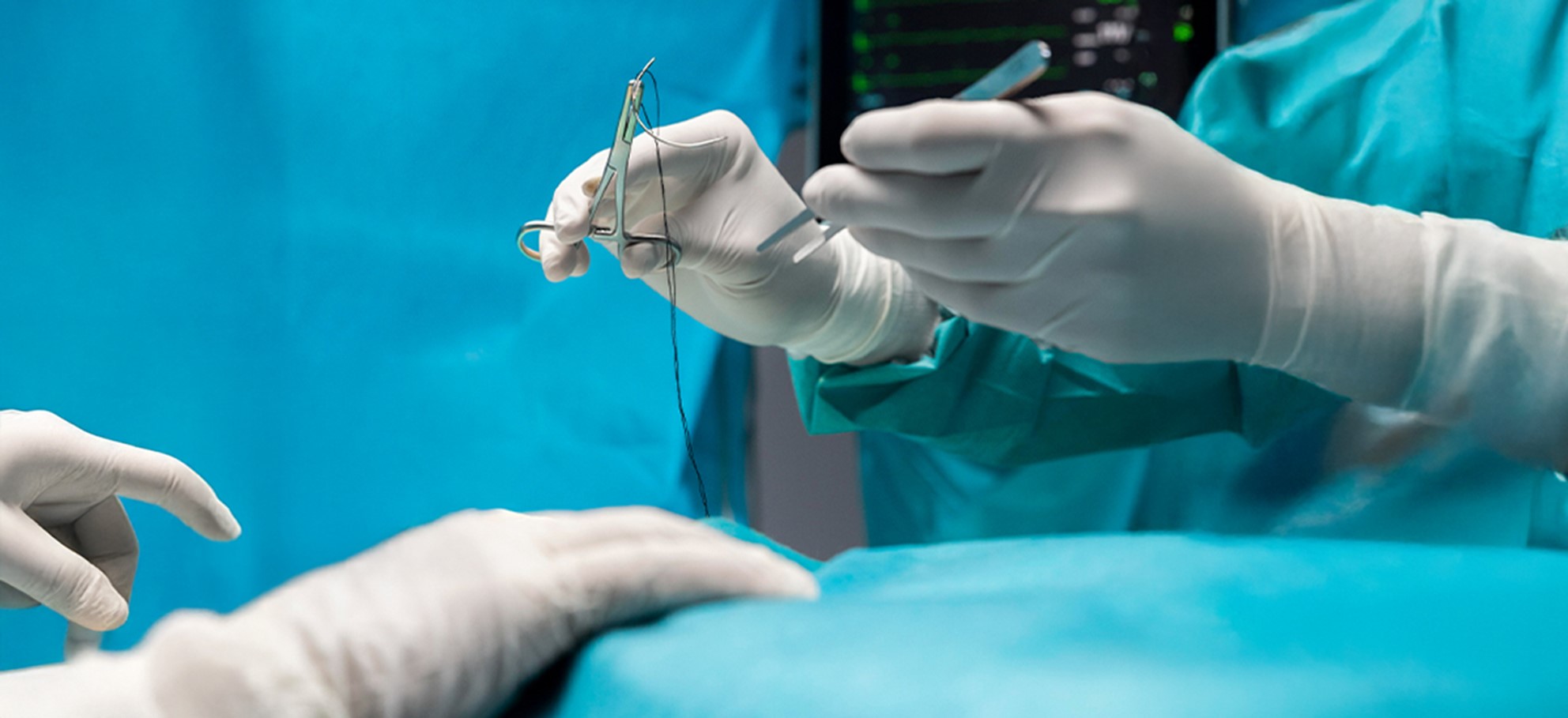 Laparoscopic Myomectomy: Expert Overview of Benefits, Risks, and Recovery Timeline