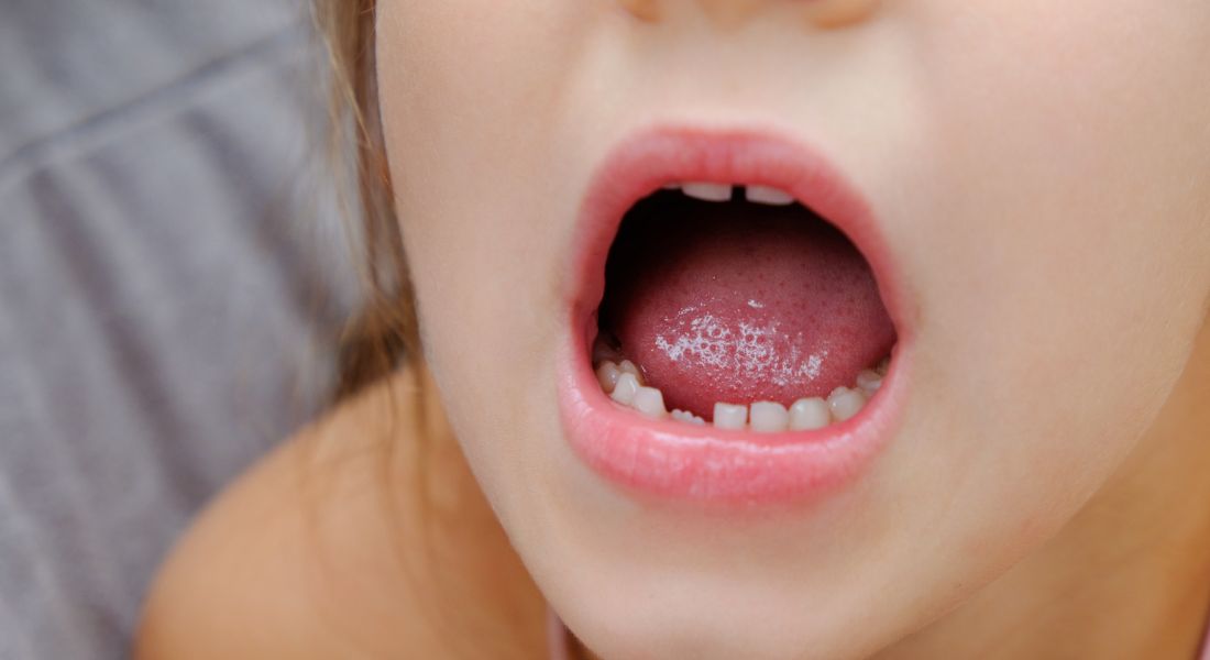 Broken Tooth