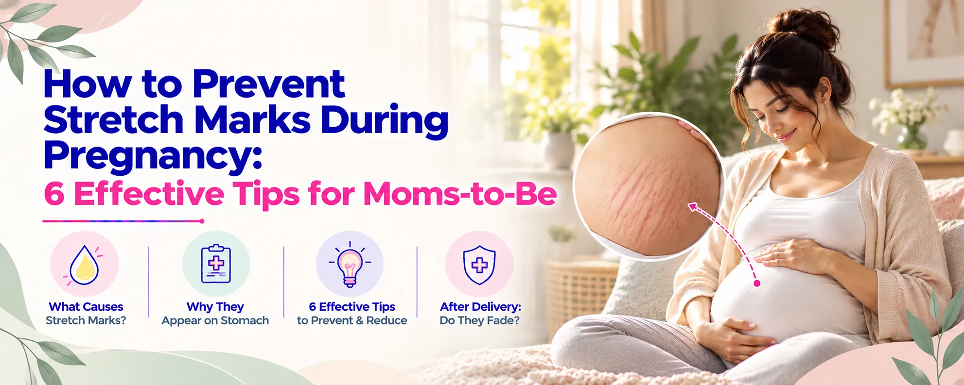 How to Prevent Stretch Marks During Pregnancy: 6 Effective Tips for Moms-to-Be