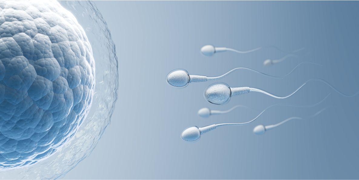 Maximizing Sperm Quality in IVF - Expert Opinion