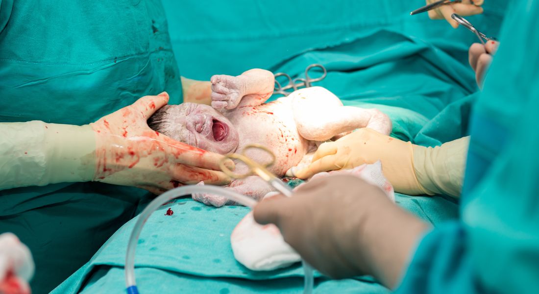 Myths About C-Section That You Should Stop Believing Today