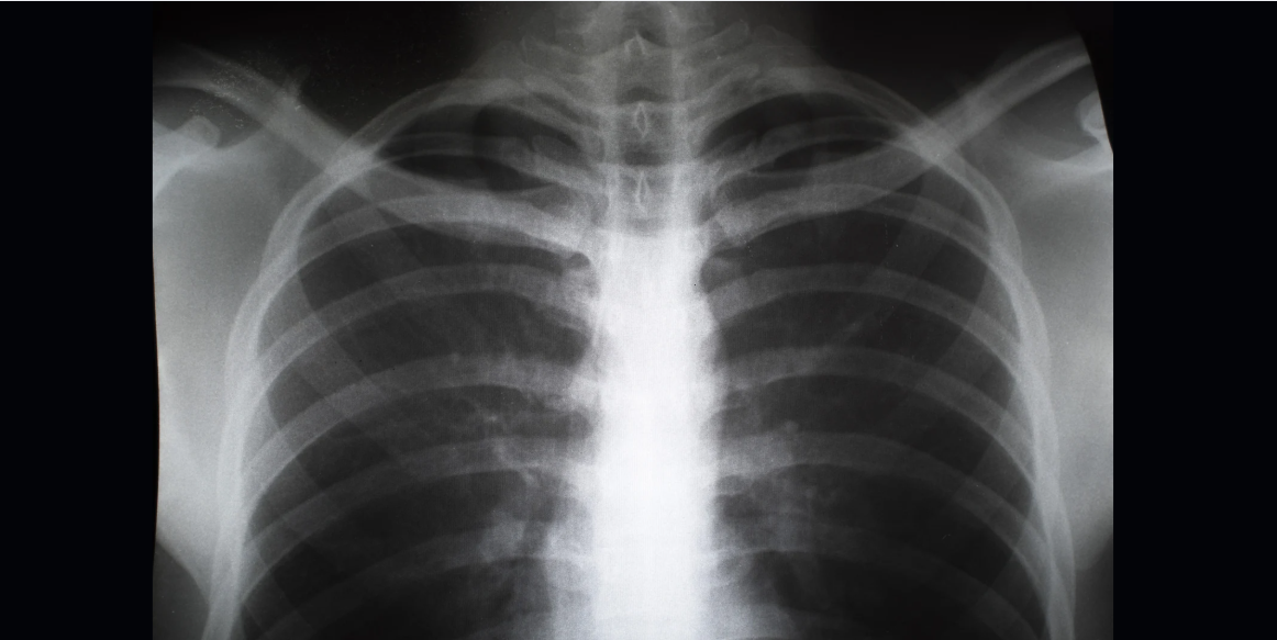 Significance of X-rays in Diagnosis