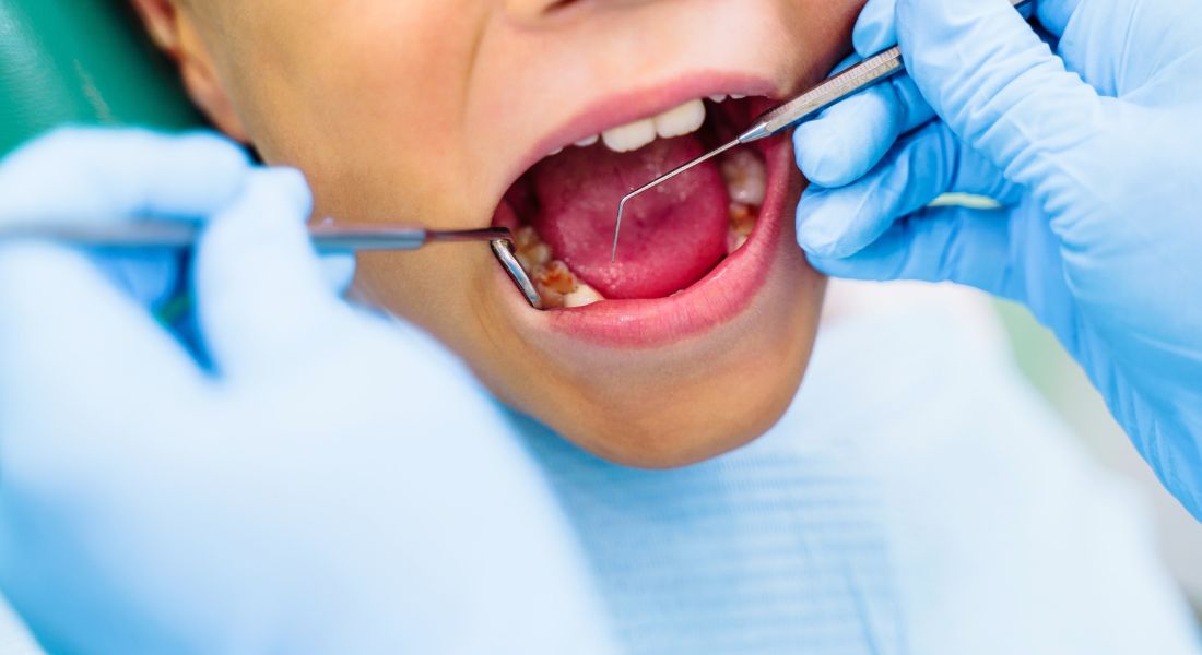 Top most common dental problems in children