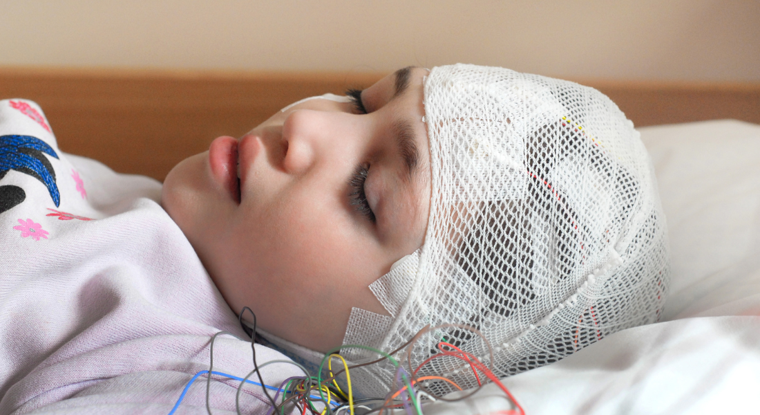 Epilepsy in Children: Making the Correct Diagnosis is Crucial