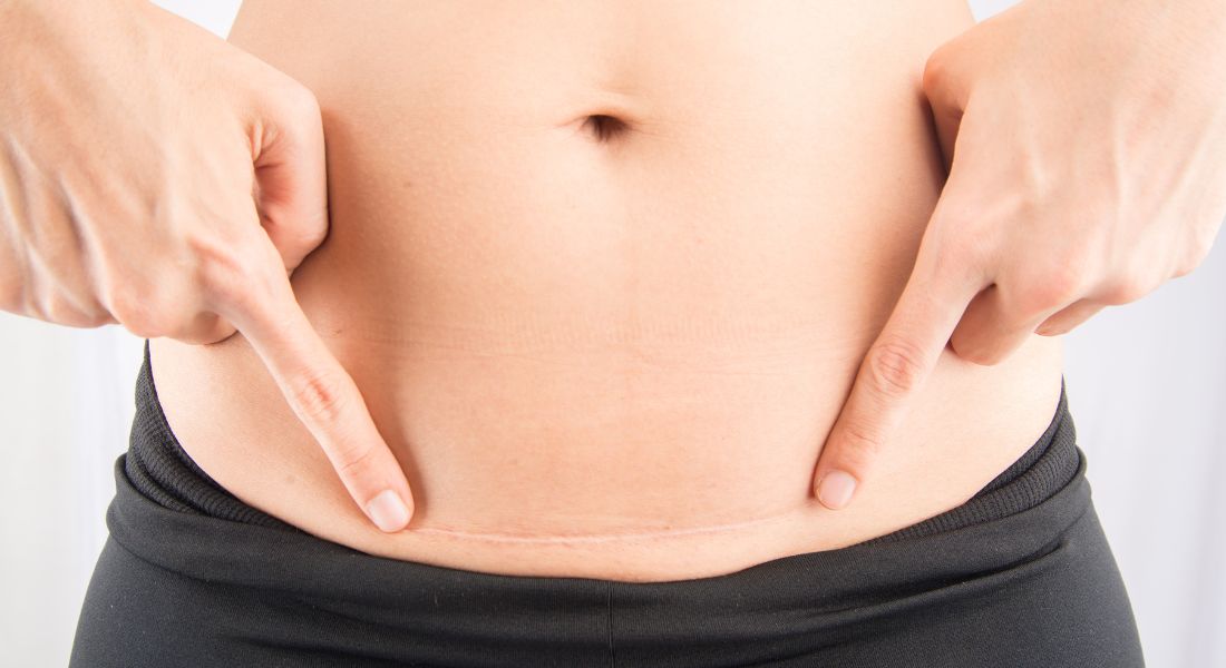 7 Tips to Recover from Labor