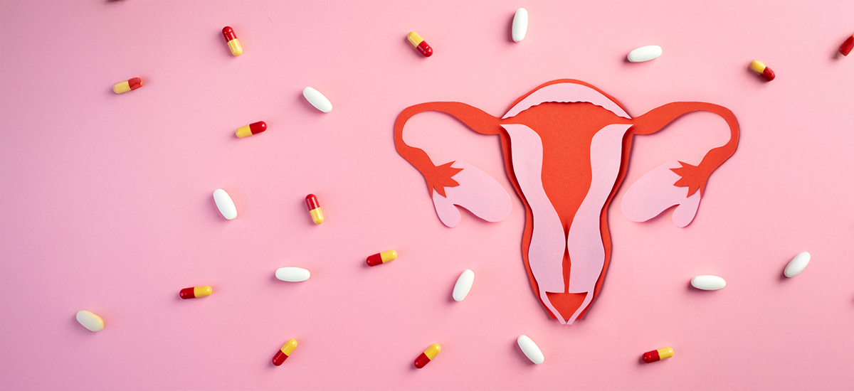 Illustration of female reproductive system surrounded by capsules symbolizing PCOS treatment