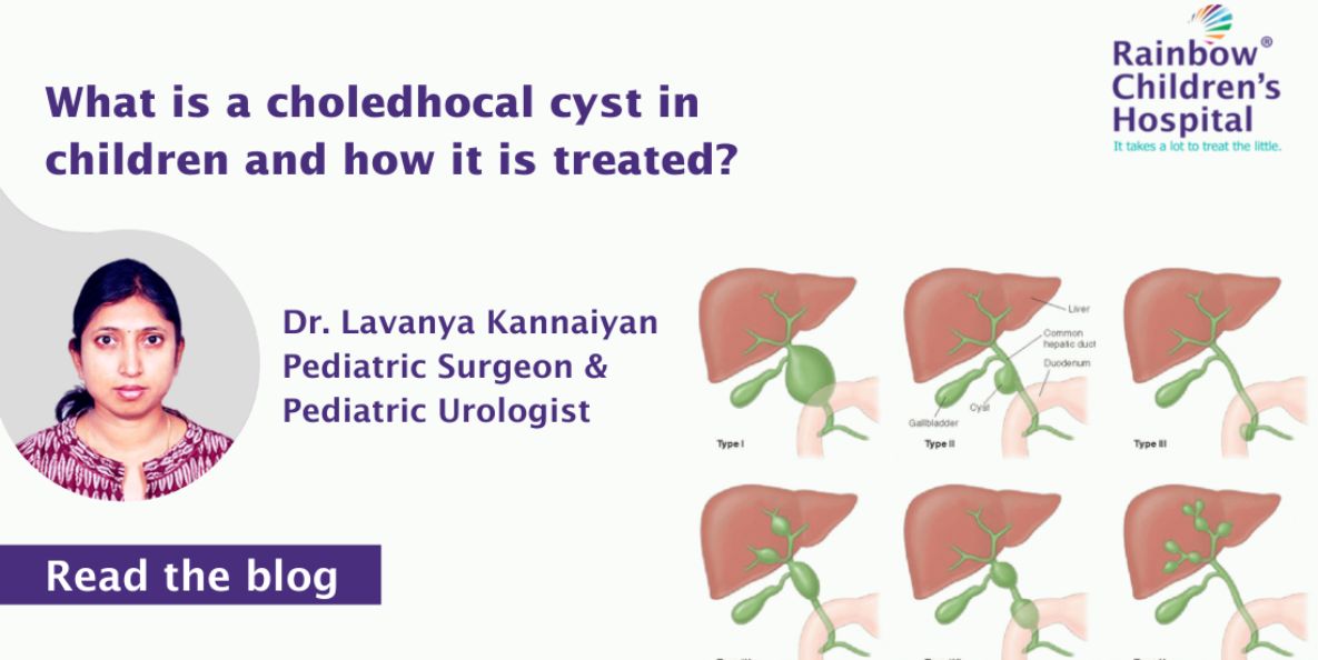 What is a choledhocal cyst in children and how it is treated?