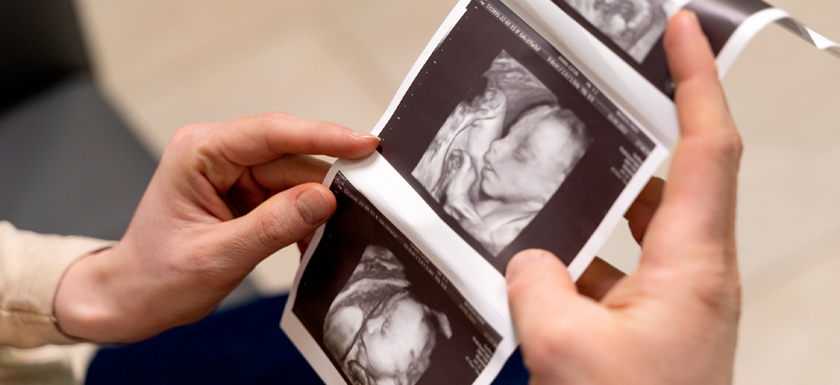 Expectant parent holding ultrasound images showing baby development at Rainbow Children’s Hospitals