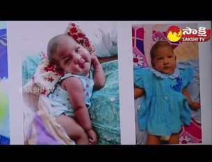 Urban Baby Saved Through Exit Procedure Delivery In Rainbow Hospital Hyderabad