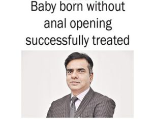 Baby born without anal opening successfully treated