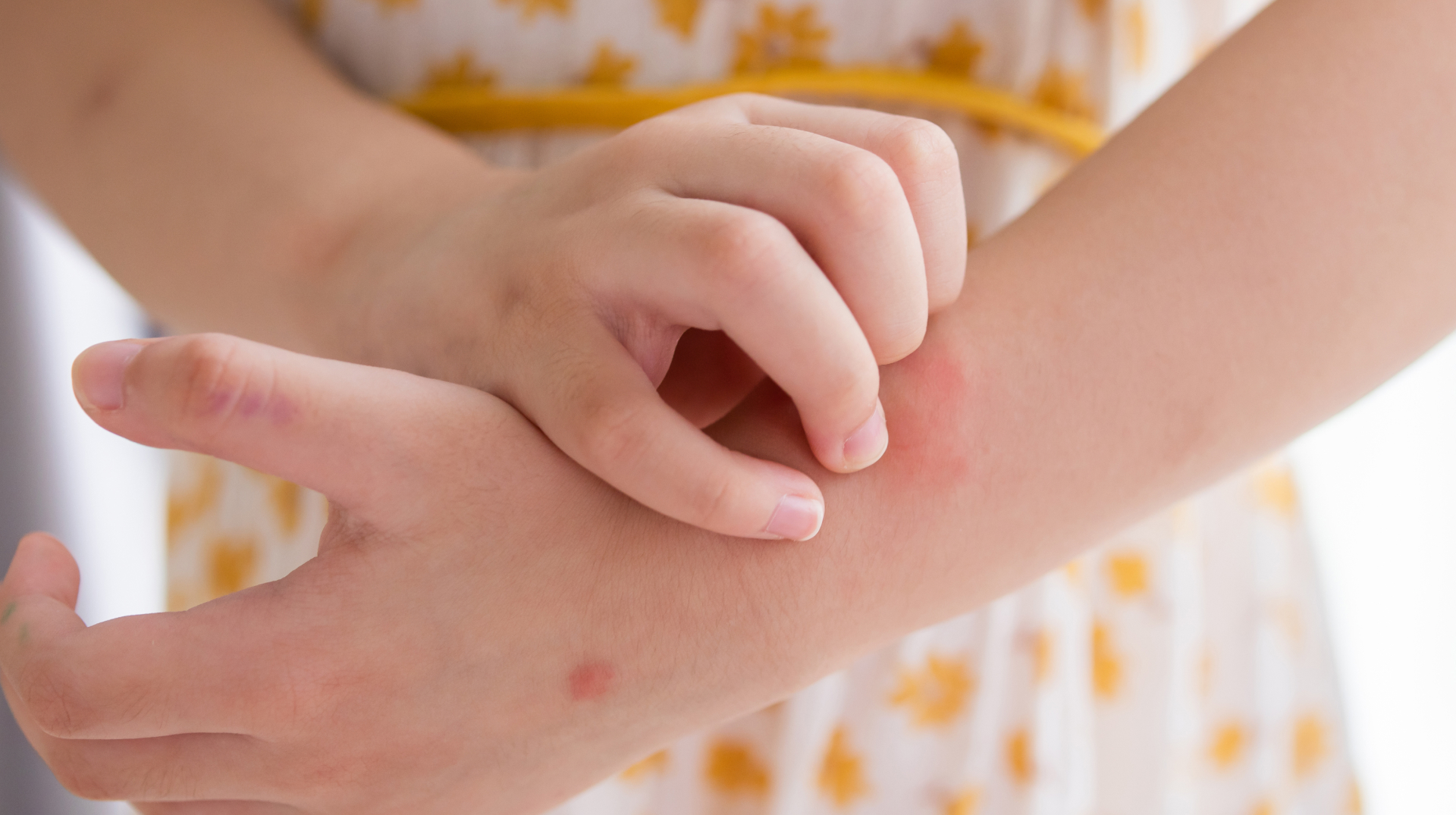 Best pediatric dermatology hospital