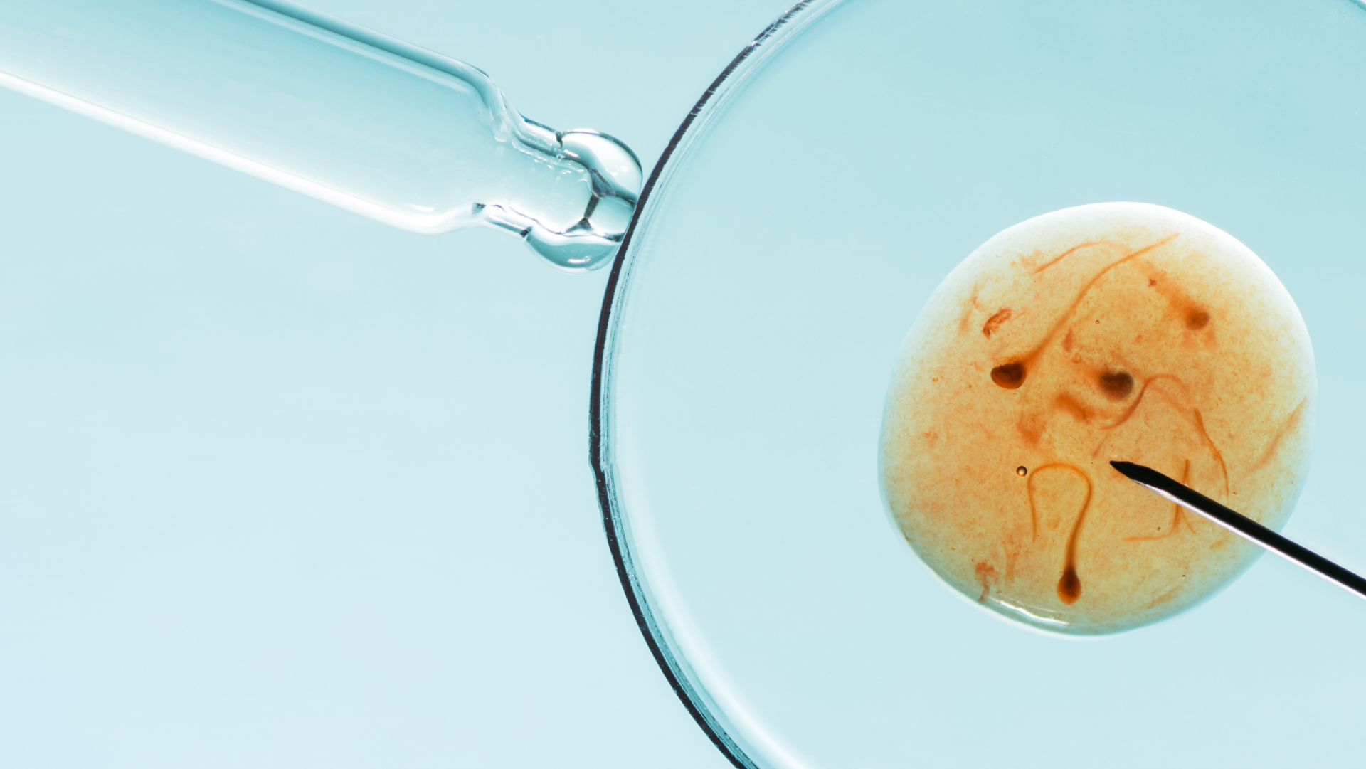 best icsi treatment